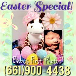 BABY ULTRASOUND EASTER SALE!!