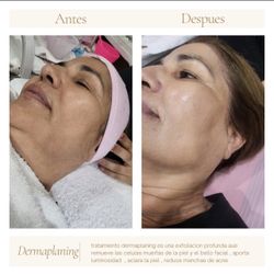 Facial Products