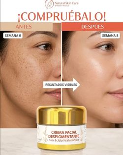 ✨ Crema Facial Despigmentante con Ácido Hialurónico y Cúrcuma (30ml) ✨