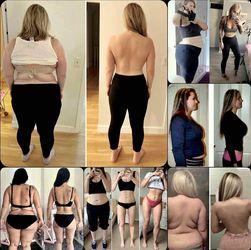 Weight Management Chupa Panza