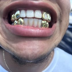 30% Off All NPG And Silver Grillz Until The End Of August 