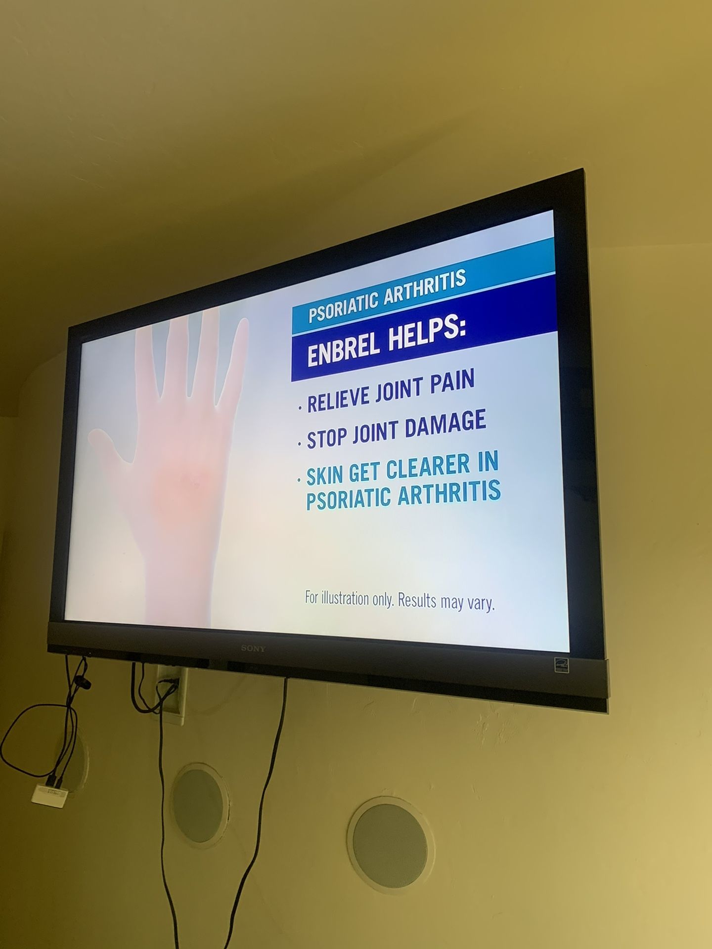 52” Sony Flat Panel Tv Not Smart Tv