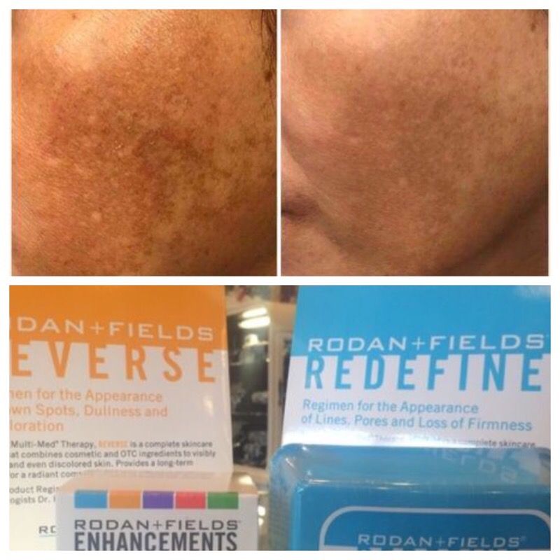 Rodan and Fields