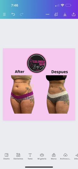lymphatic drainage -bodysculpting 