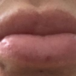 Lips
