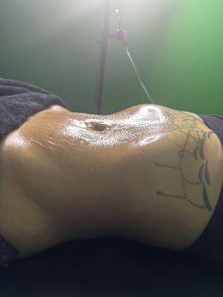 Lipo Cavitation Machine