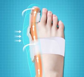 Foot orthotics