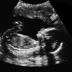 Prank Realistic Personalized ultrasounds