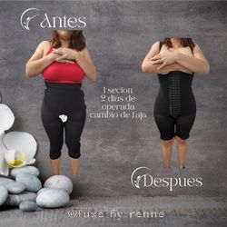 Fajas Colombianas Para Adelgazar