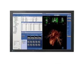 EIZO FlexScan MX240W 24" Medical Widescreen Monitor