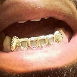 Custom Grillz Gold Or Silver