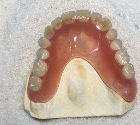 (Dentaduras, parciales e mas)
