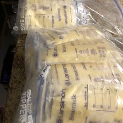 Breast Milk Oversupply 
