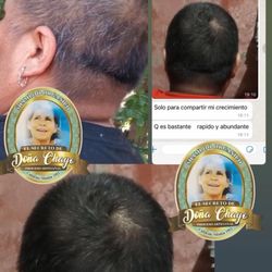 Mexican Hair Growing Shampoo 