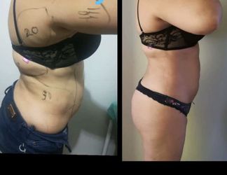 Profesional Body wraps