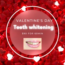 Teeth Whitening