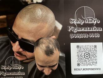 Hair Loss Solution