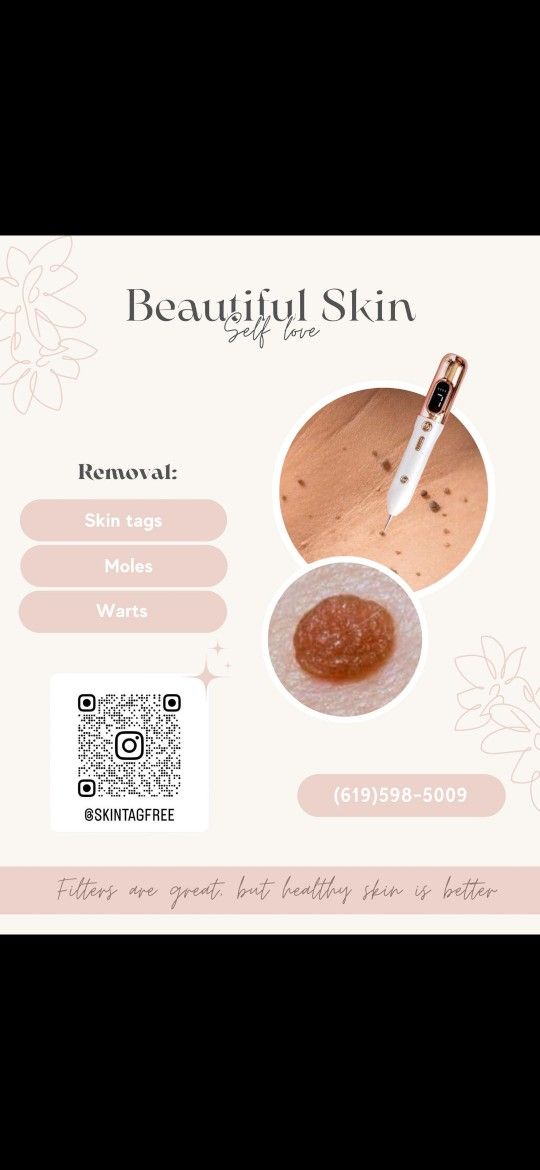 Skin Tags Removal