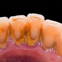 Free Dental Cleaning 