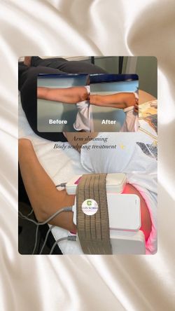 Body Sculpting Slimming Arms