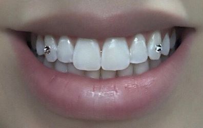 Tooth Gem