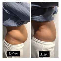 Body Sculpting