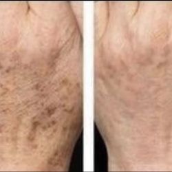 New Marykay Beauty Items DM For Price