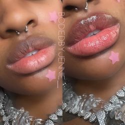 Lip Plump