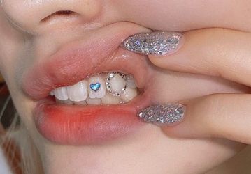 Tooth Gem