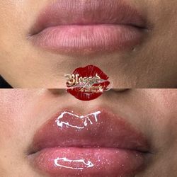 Lip Gloss