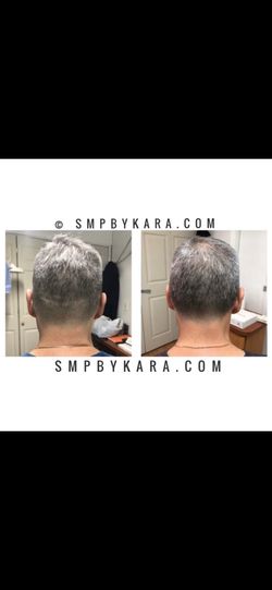Scar cover-up