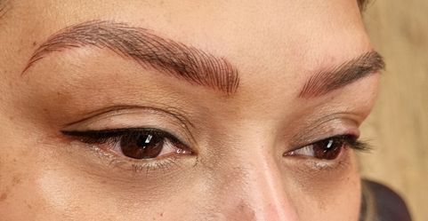 Eyebrow Microneedling