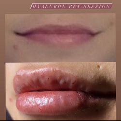Lips
