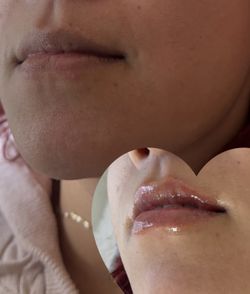 Hyaluron Lip Filler