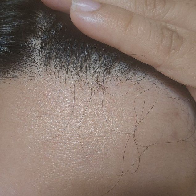 Hair Growth