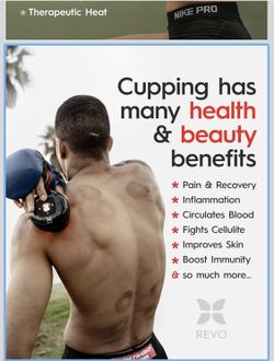 cupping device
