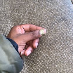 Nugget Ring