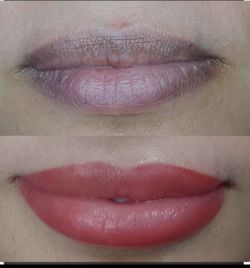Neutralización De Labios