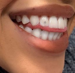 Teeth gems 💎 