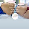 Bodysculpting And Items Sale 