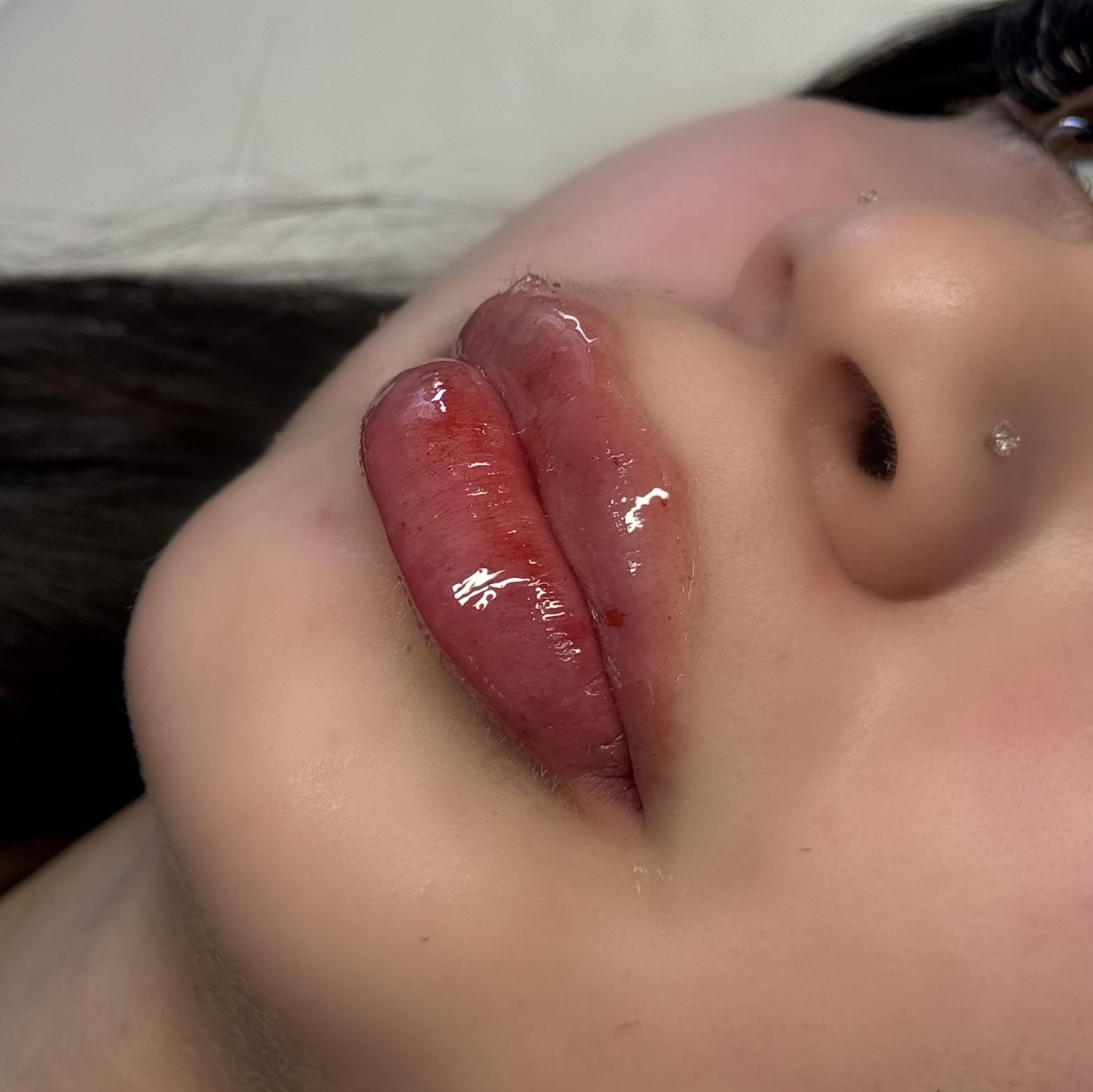 Lips