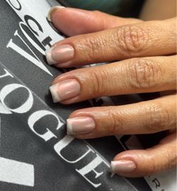 Uñas , varios sistemas