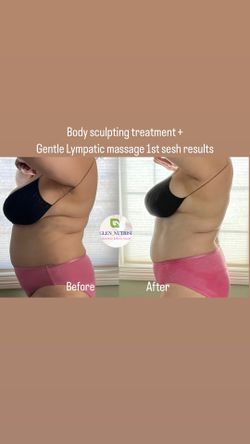 Body Sculpting Body Contouring Slimming Treatments