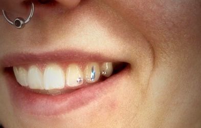Tooth Gem 🦷💎