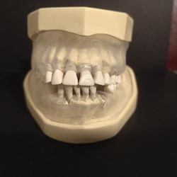 Columbia Periodontal Typodont