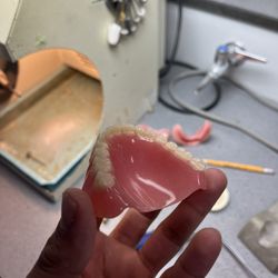 Removable aesthetics