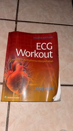 ECG Workout exercises in arrhythmia interpretation