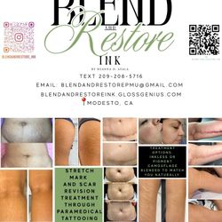 Stretch Mark And Scar Treatments