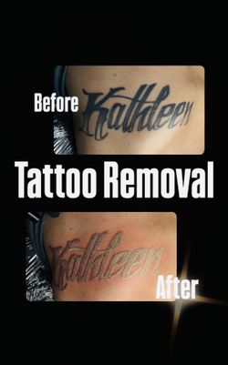 Removal