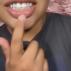 Tooth Gems 🦷✨